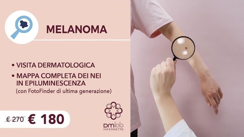 Prevenzione Dermatologica Melanoma 1