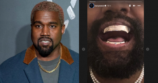 Kanye West si fa impiantare pr