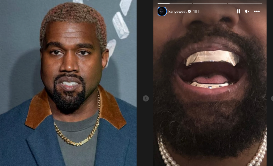 Kanye West si fa impiantare pr